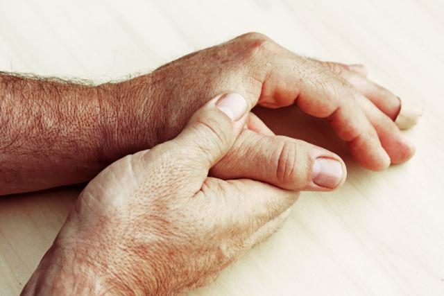 U Srbiji 35.000 ljudi boluje od reumatoidnog artritisa